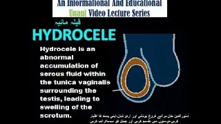 HYDROCELEقیلۂ مائیہ.CONTENTS OF VIDEOS ARE AS PER SYLLABUS FOR (BUMS) COURSE, CCIM NEW DELHI.