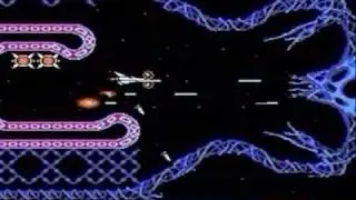 NES Tips - Gradius