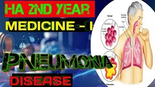PNEUMONIA (Respiratory disorder) MEDICINE I       H.A. 2nd year CTEVT