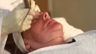 Wrinkle Reduction System - Pellev&eacute; Explained by Dr. Amy Taub