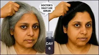Turn Grey Hair to Black Hair WITHIN WEEKS &mdash; Powerful Herbal Hair Serum (No Dye, No Chemicals)