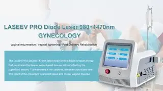 Vaginal laser therapy for gynecologic conditions Triangel TR-B