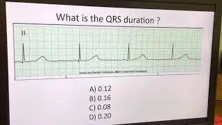 Телеметрический анализ: Видео 2: Измерение длительности комплекса QRS