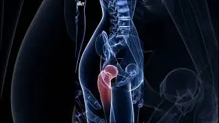 6 преимуществ коллагеновой добавки #collagen