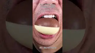 The Most Satisfying Chocolate and Candy ASMR Compilation 🍫🍬 #DoctorTristanPeh #Chocolate #Candy