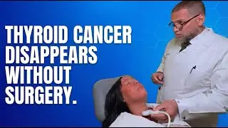 Transforming Thyroid Cancer Care: MWA as an Alternative to Surgery