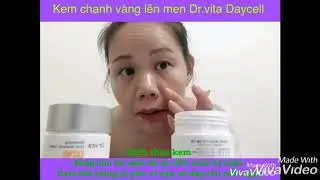 Kem chanh v&agrave;ng l&ecirc;n men Daycell d&ugrave;ng cho da n&aacute;m t&agrave;n nhang. Nếu bạn cam kết đ&uacute;ng liệu tr&igrave;nh sẽ khỏi
