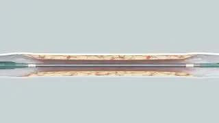 Chocolate XD&reg; PTCA Balloon Catheter