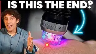 The Dark Side of MicroNeedling - Risks/ Results/ Regrets