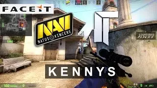 kennyS POV 40-28 vs. NaVi ( CSGO FACEIT League 2015 Stage 1)