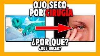 🟡 OJO SECO despu&eacute;s de cirug&iacute;a... &iquest;Qu&eacute; hago?