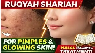Ruqyah Shariah For Pimples, Acne & Skin Problems | Quranic Healing For Clear & Glowing Face 