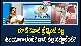 రూట్ కెనాల్ ట్రీట్మెంట్ వల్ల ఉపయోగాలేంటి ? దాని వల్ల నష్టాలేంటి ? | Benefits of Root Canal Treatment