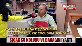 Sıcak su kolunu ve bacağını yaktı