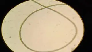 Spirulina Platensis under microscope/ with Davy Jones music - S.U.M Spirulina