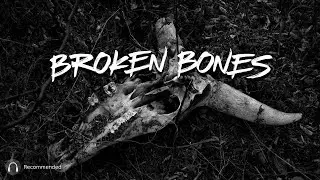 Merouve - Broken Bones