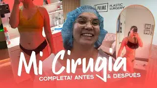 ME HICE UN BBL + lIPO 360+ JPLASMA+BRAZOS😱 En Spring Plastic Surgery | Antes y Después IMPACTANTE😍