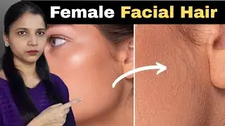 Remove Female Facial Hair Easily | Permanent and At-Home Facial Hair Removal