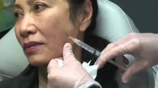 Dr. Gidon Frame: Natural-Sculpt Global fill