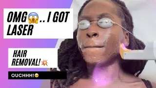 I got Laser Hair Removal ! On Dark skin/Does it hurt? ACTUAL VIDEO vlog