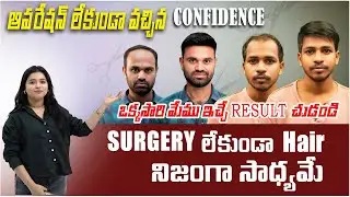 సర్జరీ లేకుండా Hair&hellip; నిజంగా సాధ్యమే | Hair Patch for Bald Men &ndash; Natural Look in Just Hours