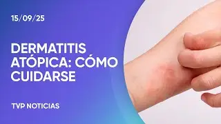 Dermatitis at&oacute;pica: por qu&eacute; se detectan cada vez m&aacute;s casos en adultos