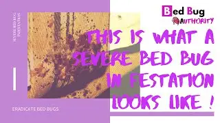 (WHAT IS A BAD BED BUG INFESTATION?)WHAT DOES IT LOOK LIKE |BED BUG AUTHORITY |DIY BED BUG SOLUTIONS