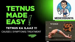 Tetanus Made Easy | Causes, Symptoms, Prevention & Treatment Explained | tetnus ka ilaaz 