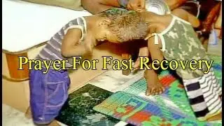 Odisha: Govt Help 1 Corer, News Joint Surgery For Joint Twins.