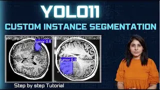 YOLO11 Instance Segmentation on Custom Dataset | Step-by-Step Tutorial