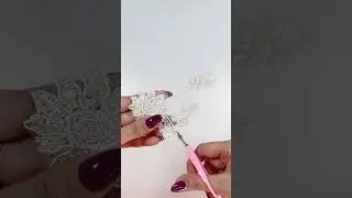 Incredible Recycling of Old Lace!! Everyone Who Saw This Idea Was Amazed!The best of waste 😍DIY