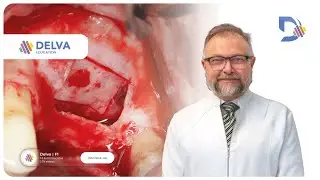 Imers&atilde;o em levantamento de seio maxilar  - Sinus