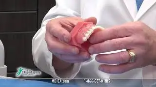 Mini Dental Implants