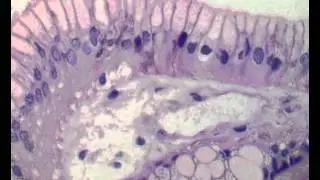 NG 001