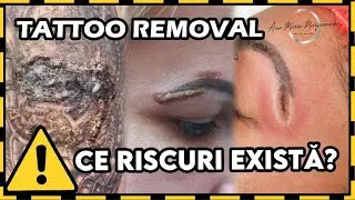 Riscuri & Reguli în TATTOO REMOVAL