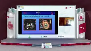 TCT 2021 | Mitral Valve & TV Interventions | Dr Ashish Pershad | Arena 2 - Day 1