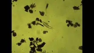 Bdelloidea Rotifer Philodina in motion