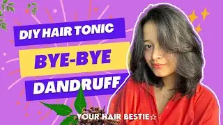 How to Get Rid of Dandruff - Clear Scalp in 7 Days | Stop Hair Fall & Flakes | Natural Home Remedies