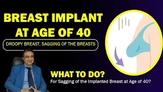 Breast Drooping/Sagging With Aging | How To Fix Breast Ptosis? Breast Lift Surgery By Dr PK Talwar