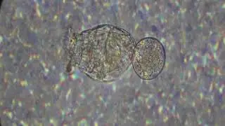 Wrotek-Keratella cochlearis