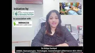 IMPORTANCE OF PHYSIOTHERAPY IN BURN PATIENTS BY Dr.Shilpa Sankpal (Sr.Skin Specialist)