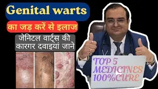 Top 5 Medicines for Genital Warts in homeopathy|Human papilloma virus|जननाॅगों के मस्से| condyloma
