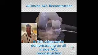All Inside ACL Reconstruction