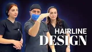 Perfect Hairline Design by Dr. Resul Yaman