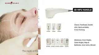 HIFU SmasFocus Mini  machine d'&eacute;limination des rides/dispositif de lifting du visage