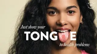 Wellbeing Nutrition | Show Your Tongue to Health Problems