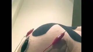 Electro acupuncture techniques for the shoulder