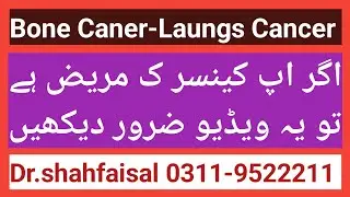 #bones cancer# laughs cancer#4stage# return patients #Dr.shahfaisal