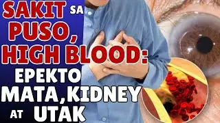 Sakit sa  Puso, High Blood: Epekto sa Mata, Kidney at Utak - Payo ni Doc Willie Ong