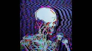 [FREE] BONES TYPE BEAT - OverGrown